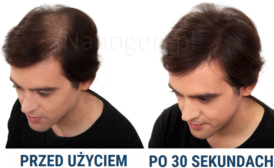 sposób użycia